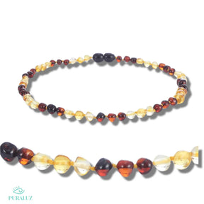 Amber necklace for babies; Therapeutic amber jewelry; Baby teething necklace; Amber bracelet for adults; Soothing amber jewelry; Amber teething relief; Natural pain relief necklace; Calming amber for babies; Amber wellness jewelry; Healing amber stones; Baltic amber for babies; Therapeutic amber bracelet; Baby and adult amber set; Amber teething beads; 